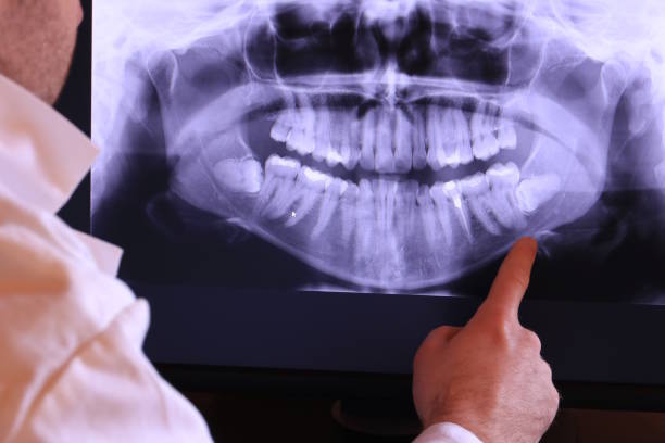 Best Chipped Tooth Repair Near Me  in Parksdale, CA