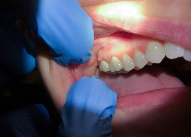 Best Emergency Gum Pain Relief  in Parksdale, CA