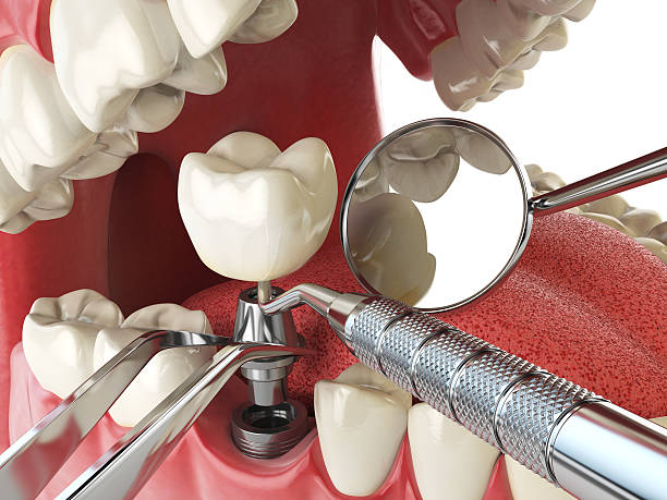 Best Broken Tooth Emergency  in Parksdale, CA