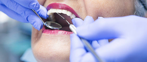 Best Dentist for Dental Trauma  in Parksdale, CA